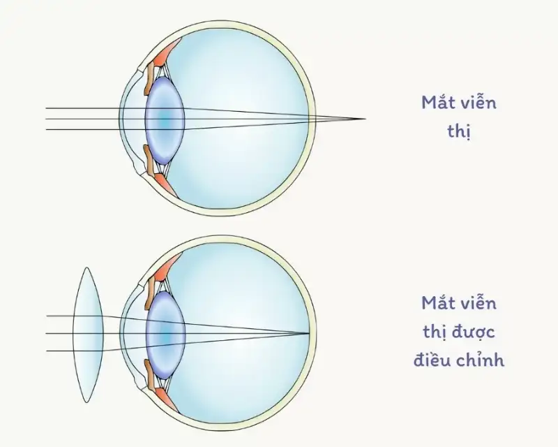 Kinh cho nguoi vien thi 3
