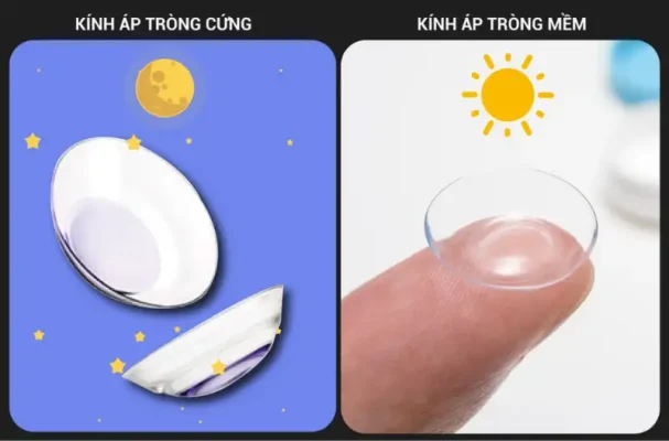 Ưu Nhược Điểm Của Kính Áp Tròng: Cẩm Nang Toàn Diện 3 Uu nhuoc diem kinh ap trong 2