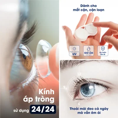 Ưu Nhược Điểm Của Kính Áp Tròng: Cẩm Nang Toàn Diện 5 Uu nhuoc diem kinh ap trong 6