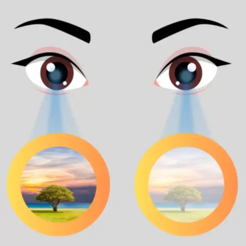 do can cua mat la gi 6